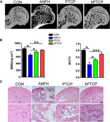 Cryogenic 3D Printing of ß-TCP/PLGA Composite Scaffolds Incorporated With BpV (Pic) for Treating Early Avascular Necrosis of Femoral Head